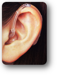 耳かけ型挿入耳